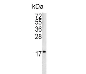 Anti-Caveolin-3 / CAV3