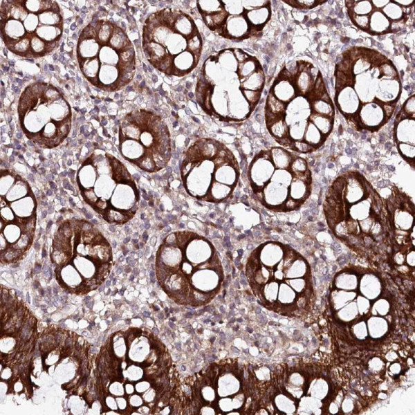 Anti-PHLDB1