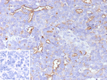 Anti-MUC16 / Cancer antigen 125, clone CA125/9923R