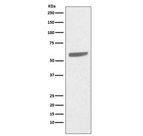 Anti-Cytokeratin 5 / KRT5, clone FBE-11