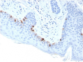 Anti-TRP1 / Tyrosinase-Related Protein-1, clone TYRP1/3283