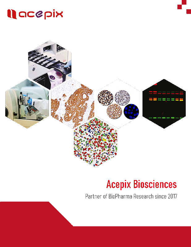 Acepix Products and Services