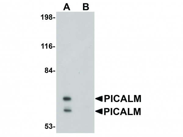 Anti-PICALM