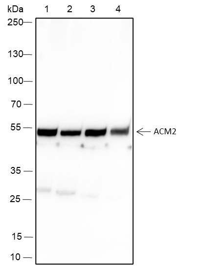 Anti-Recombinant Muscarinic Acetylcholine Receptor 2/CM2, clone A121