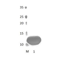 DLG2_1 PDZ Domain