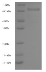 Hyaluronidase PH-20 (SPAM1), human, recombinant