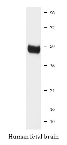 Anti-PRKAR2B / PKA RII beta