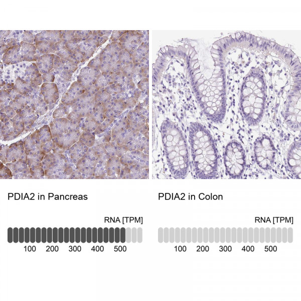 Anti-PDIA2