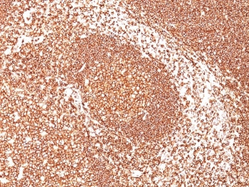 Anti-CD45 (Leukocyte marker), clone 2B11