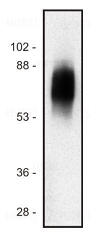 Anti-SIT Monoclonal Antibody (Clone:SIT-01)