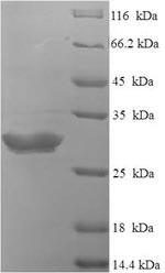 Neurotensin/neuromedin N (NTS), partial, human, recombinant