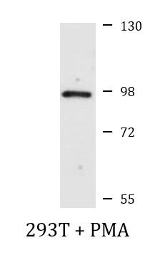 Anti-phospho-PKC (pan) (beta II (Ser660))