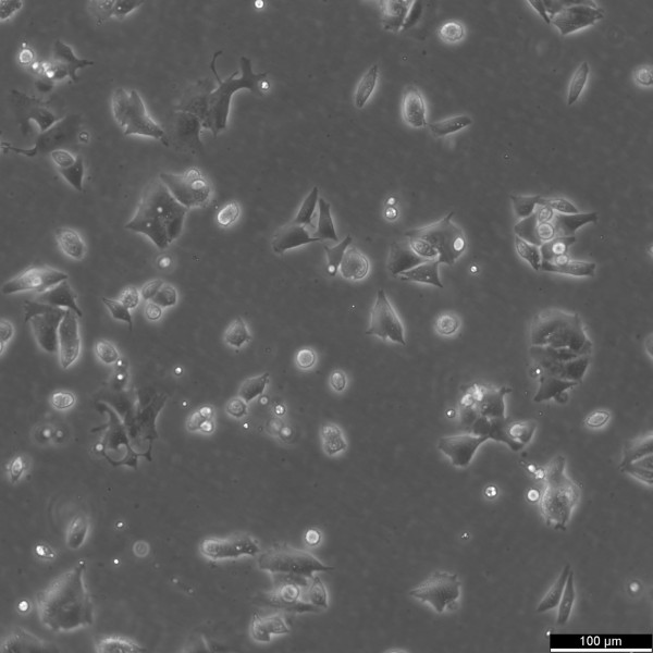 HCT-8 (HRT-18) Cells
