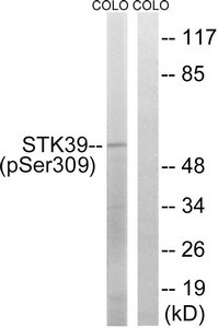 Anti-Phospho-STK39 (Ser311)