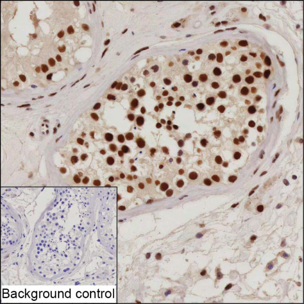 Anti-RANBP3
