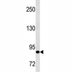 Anti-MMP9, clone 331CT17.4.4