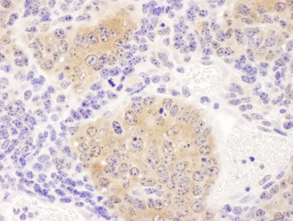 Anti-CCT8