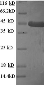 Homer protein homolog 1 (HOMER1), human, recombinant