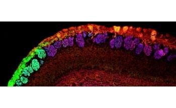 Anti-NCAM2