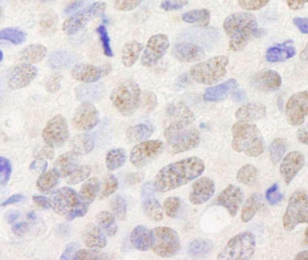 Anti-TIF1 Alpha/TRIM24 (IHC)