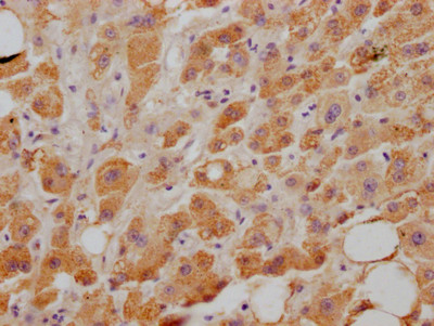 Anti-NPC1L1 Recombinant Monoclonal, clone 4B10