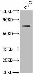 Anti-DVL1P1