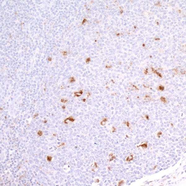 Anti-CD68 Recombinant Monoclonal