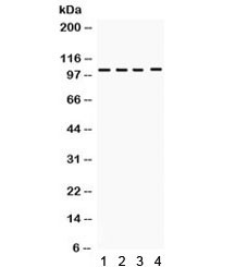 Anti-HDAC7