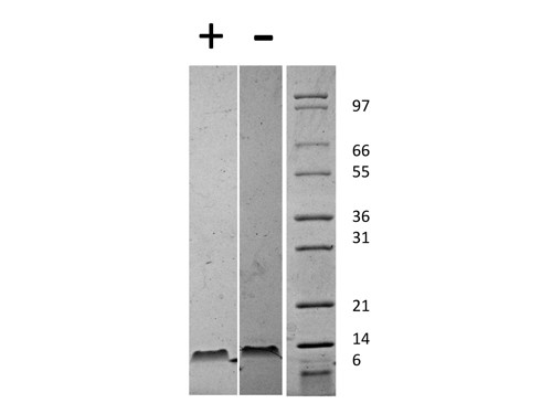 Stromal Cell-Derived Factor-1 beta (CXCL12)