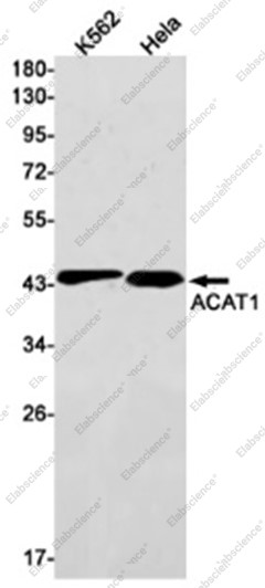 Anti-Recombinant ACAT1, clone C122621
