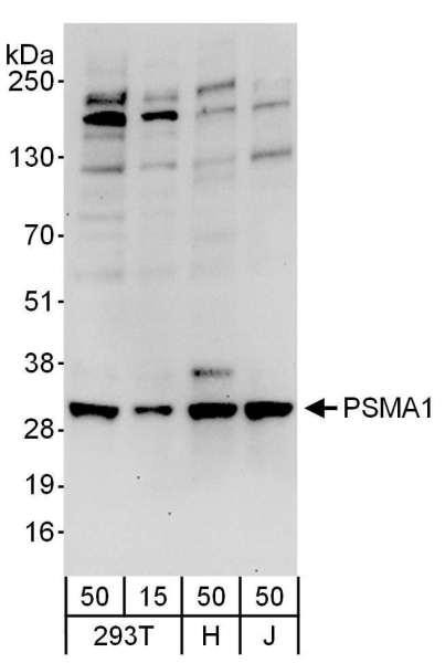 Anti-PSMA1