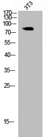 Anti-Phospho-GYS1 (S645)