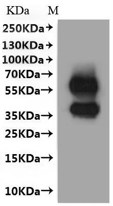 Membrane spanning 4-domains A1 (Ms4a1)-VLPs, rat, recombinant