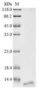 Kita-kyushu lung cancer antigen 1 (CT83), partial, human, recombinant
