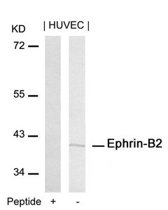 Anti-EFNB2 (Ab-316)