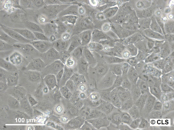 MA-Balb Cells