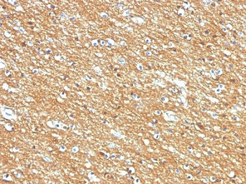 Anti-NCAM / CD56, clone 56C04, also called 123A8