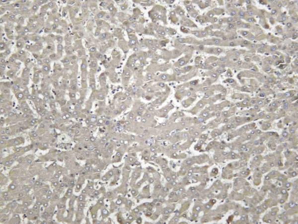 Anti-Recombinant Haptoglobin, clone C112317