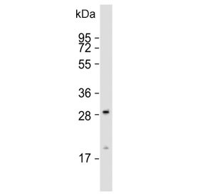 Anti-GCLM / Glutamate-Cysteine Ligase Regulatory Subunit