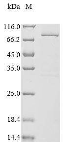 Dystroglycan (DAG1), partial, human, recombinant
