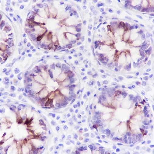 Anti-Recombinant MUC4, clone A114