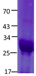 NFE2L2 Protein D77V mutant