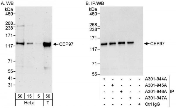 Anti-CEP97