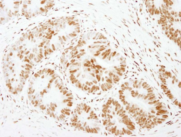 Anti-FOXK1 (IHC)