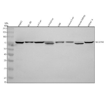 Anti-SLC27A2 / FATP2