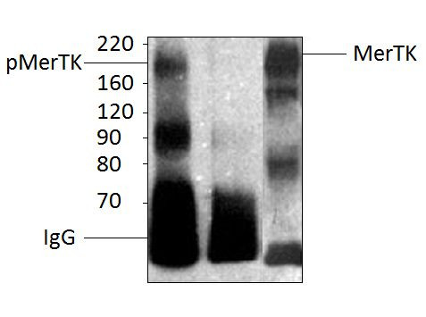 Anti-Phospho-MERTK