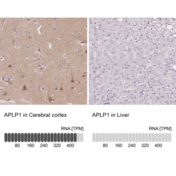 Anti-APLP1