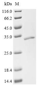 Polyribonucleotide nucleotidyltransferase (pnp), partial, recombinant Stenotrophomonas maltophilia