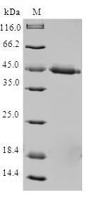 Mitochondrial import inner membrane translocase subunit Tim17-A (TIMM17A), human, recombinant