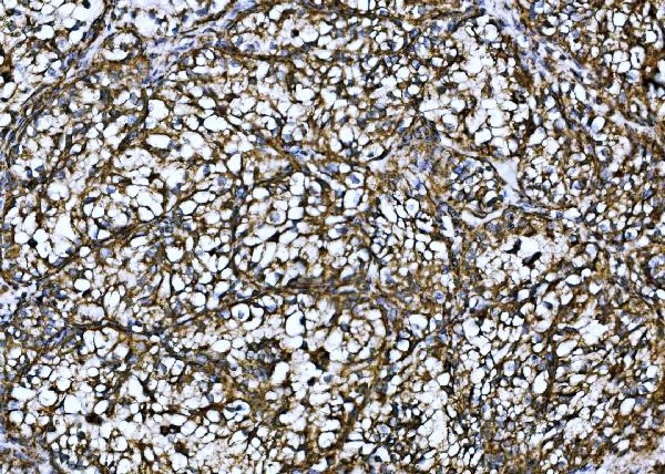 Anti-Pyruvate Dehydrogenase E2
